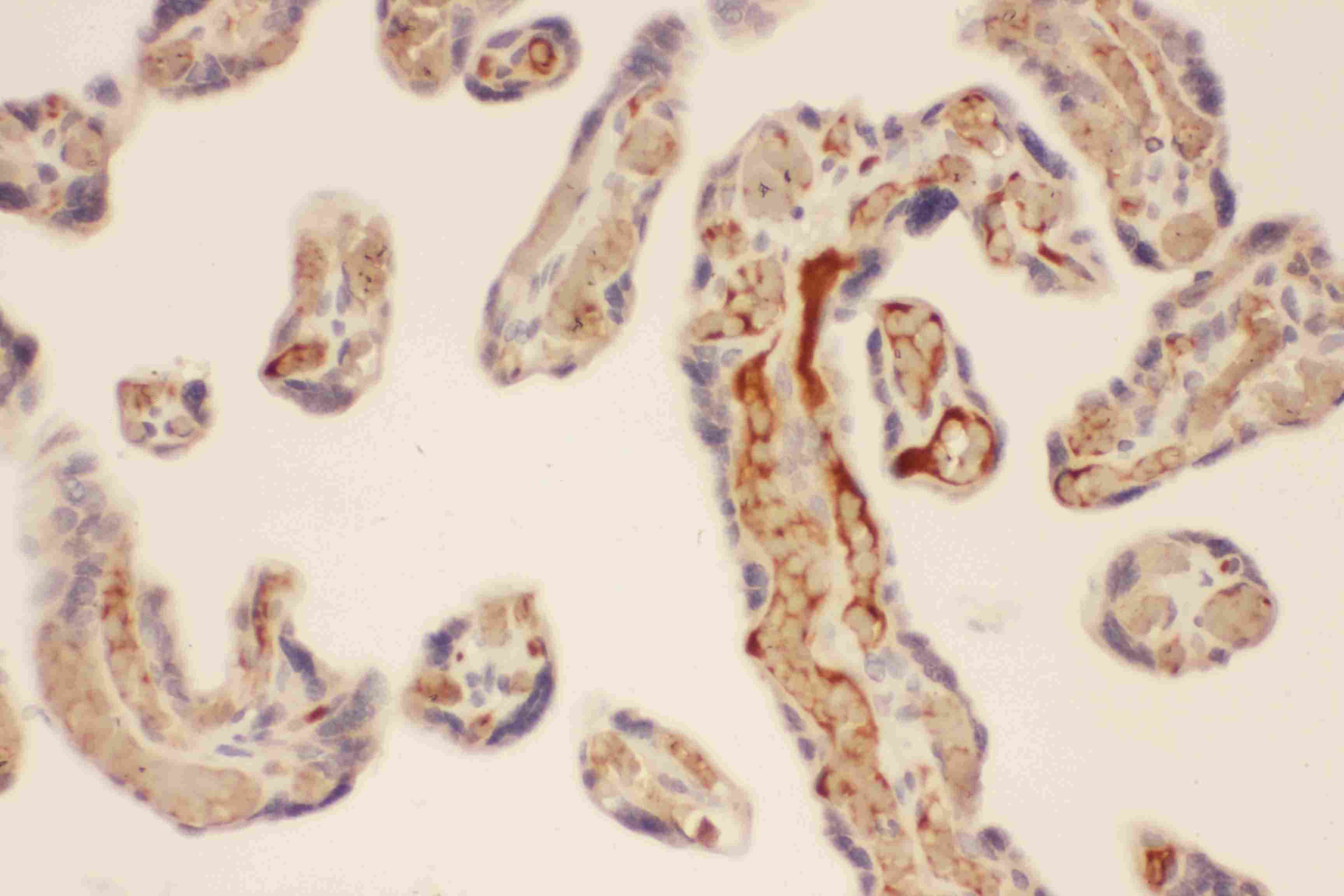 CMA1 / Mast Cell Chymase Antibody (aa22-247)
