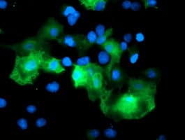RFPL3 Antibody (clone OTI2G4)