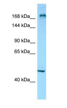 Polyclonal Rabbit anti-Human MYOM1 / Myomesin 1 Antibody (C-Terminus, WB)