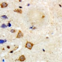 Polyclonal Rabbit anti-Human TRAF6 Antibody (Internal, IHC, WB)