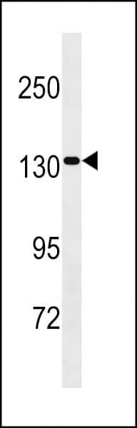 Polyclonal Rabbit anti-Human PPP6R2 / SAPS2 Antibody (aa565-593, WB)