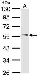 Polyclonal Rabbit anti-Human TP53 / p53 Antibody (WB)