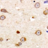 Polyclonal Rabbit anti-Human ME3 Antibody (C-Terminus, IHC, WB)