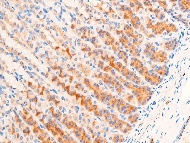 TGFB1 / TGF Beta 1 Antibody