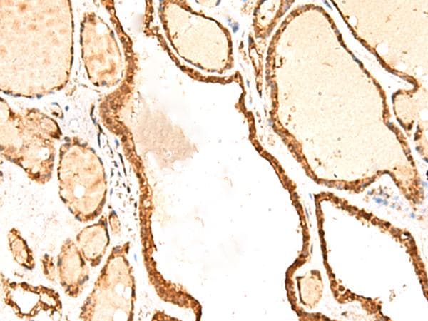 FAM134B Antibody
