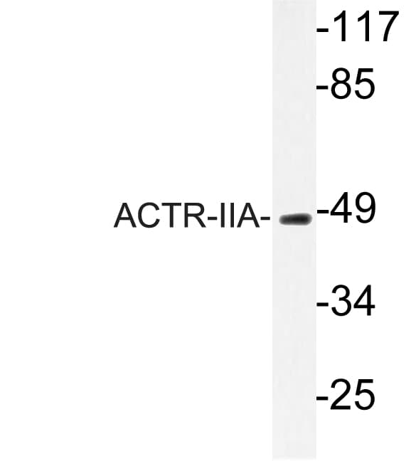 ACVR2 / ACVR2A Antibody (aa10-59)