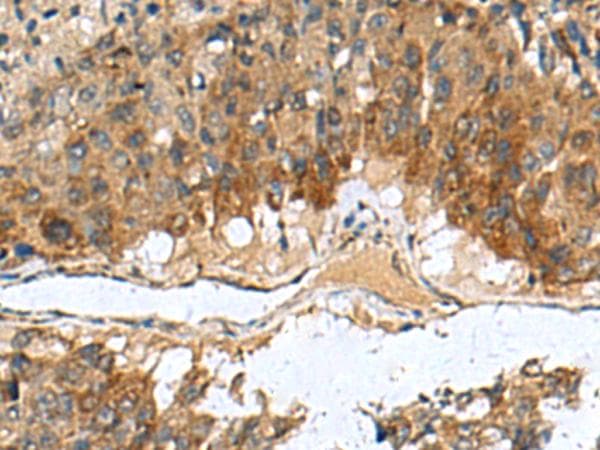 TGM3 / Transglutaminase 3 Antibody
