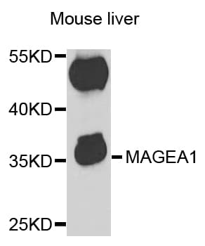 MAGEA1 / MAGE 1 Antibody