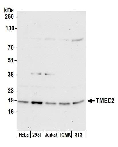 Polyclonal Rabbit anti-Human TMED2 Antibody (aa25-75, WB)