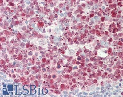 PathPlus™ Polyclonal Rabbit anti-Human PCNA Antibody (aa61-110, IHC, WB)