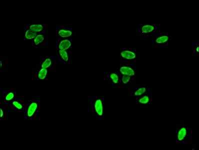 Polyclonal Rabbit anti-Human HIST1H3A Antibody (IHC, IF, WB)
