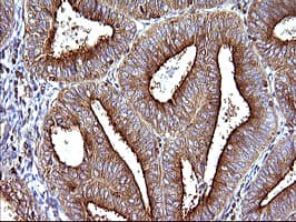 SCAMP2 Antibody (clone OTI3C2)