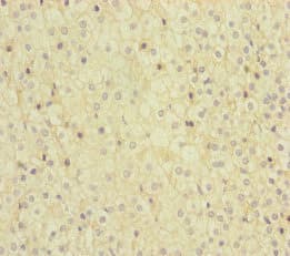 MMACHC Antibody