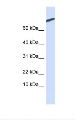 Polyclonal Rabbit anti-Human RCS / ARPP-21 Antibody (aa74-123, IHC, WB)