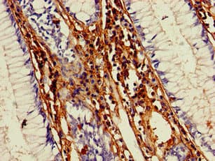 MMP13 Antibody