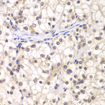 Polyclonal Rabbit anti-Human USF1 / USF Antibody (IHC, IF, WB)