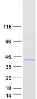 Human ATP8B2 Protein (Recombinant Myc-DDK (Flag))