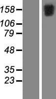 FSCB Protein (Over-Expression Lysate Myc-DDK (Flag))