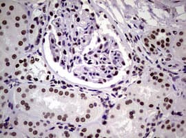 NBN / Nibrin Antibody (clone OTI6H7)