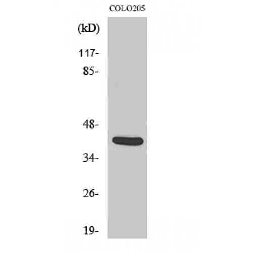 Vasohibin 1 / VASH1 Antibody (230-310 aa, Internal)