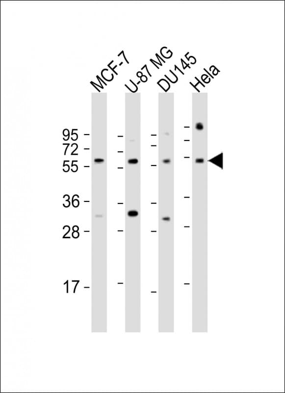 RGS3 Antibody (aa273-307)