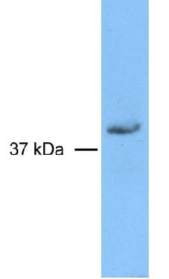 RAD51L3 / RAD51D Antibody (clone 5B3/6)