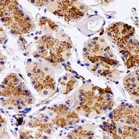 IHC-plus™ SGSH Antibody