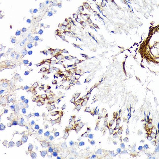 TNFRSF1A / TNFR1 Antibody