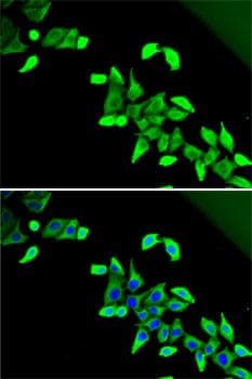 CDKAL1 Antibody