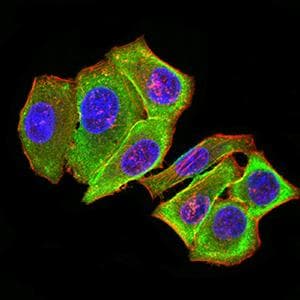 PRKAB2 / AMPK Beta 2 Antibody (clone 8F5B2)