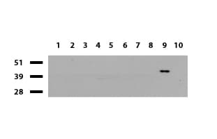 BBOX1 / BBOX Antibody (clone UMAB120)