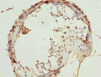 ULK4 Antibody