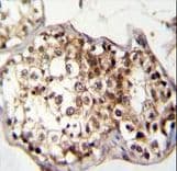 CNOT7 Antibody (aa34-61)
