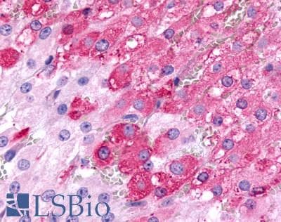 PathPlus™ FSH Receptor / FSHR Antibody (N-Terminus)