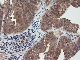 TCL / RHOJ Antibody (clone OTI2C9)