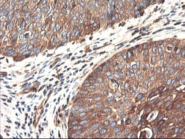 PFKP Antibody (clone OTI2E8, Carrier-free)