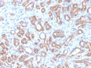 CTNNB1 / Beta Catenin Antibody (clone CTNNB1/1509)