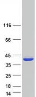 Human MTHFD2L Protein (Recombinant Myc-DDK (Flag))