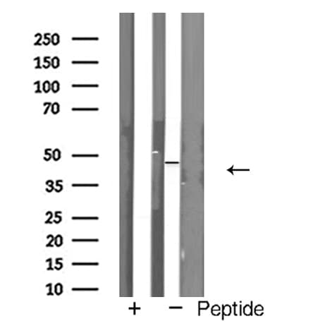 NGFR / CD271 / TNR16 Antibody