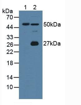 GIF / Intrinsic Factor Antibody (aa31-288)