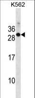 Polyclonal Rabbit anti-Mouse RAB17 Antibody (aa83-110, WB)