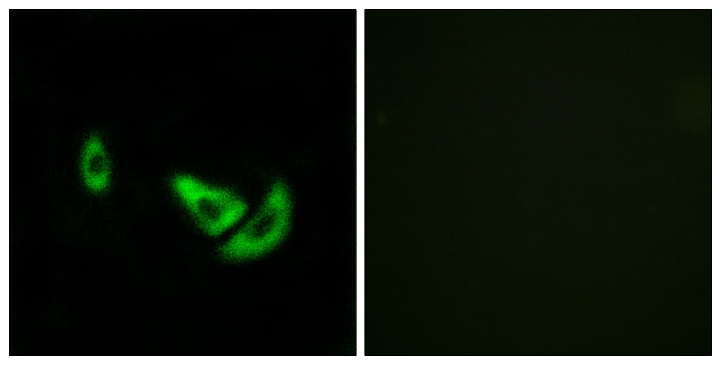 IHC-plus™ DCT / Dopachrome Tautomerase Antibody (aa51-100)