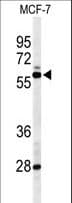 NR1H3 / LXR Alpha Antibody (aa226-253)