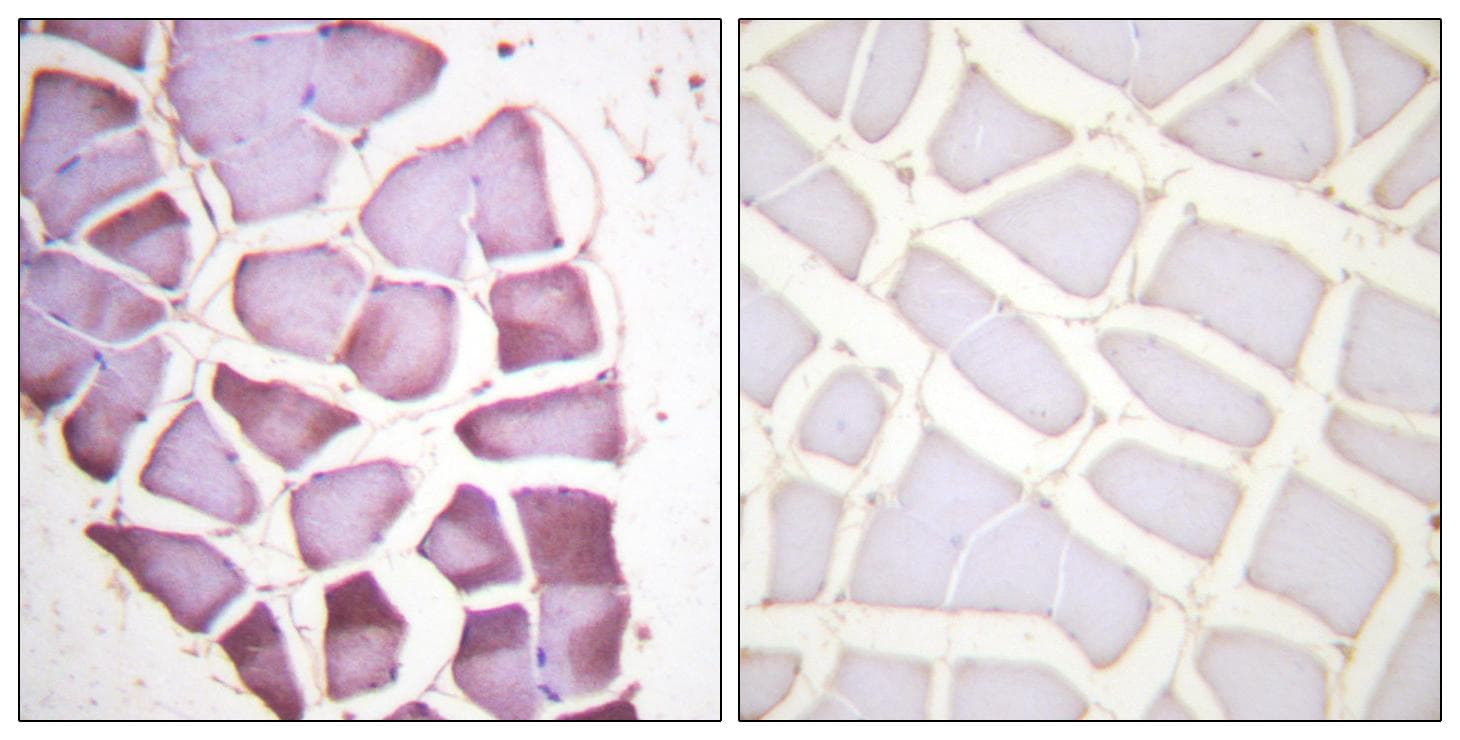 RPS6 / Ribosomal Protein S6 Antibody (phospho-Ser240)