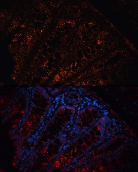 APC Antibody