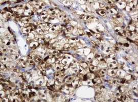 TP / Thymidine Phosphorylase Antibody (aa311-482, clone 7A6, Carrier-free)