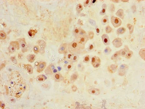SLC30A8 / ZNT8 Antibody