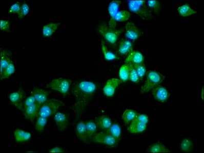 DCLRE1B Antibody