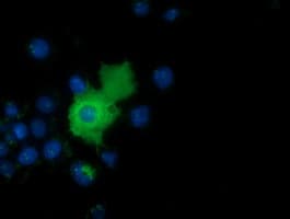 AK5 / Adenylate Kinase 5 Antibody (clone OTI2F9)