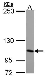 Polyclonal Rabbit anti-Human GRIK4 / KA1 Antibody (WB)